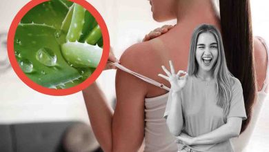 Come riparare una scottatura con l'aloe vera