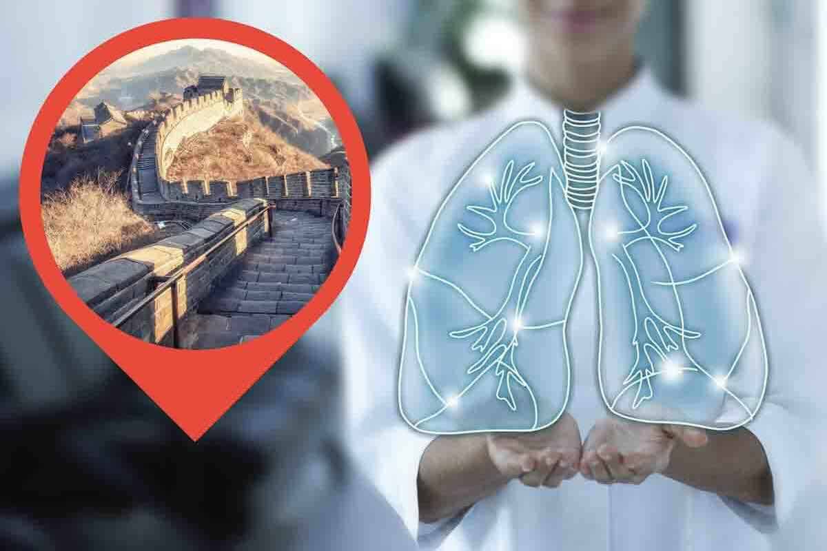 misteriosa polmonite cinese
