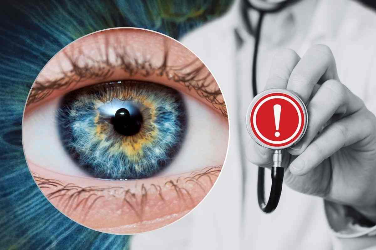 Occhi indicatori della nostra salute