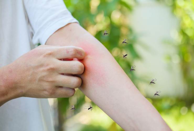 Come sbarazzarsi delle zanzare in maniera naturale