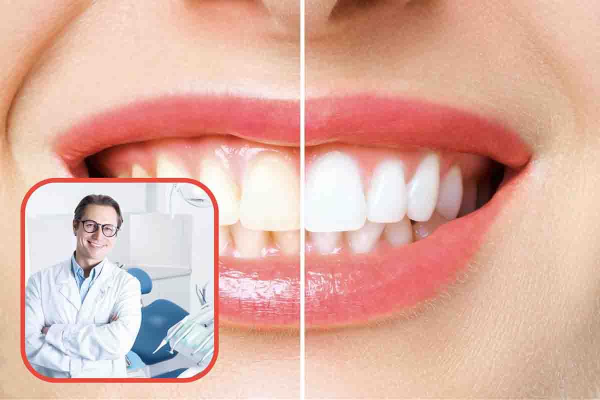 Denti: come avere un sorriso bianco e smagliante